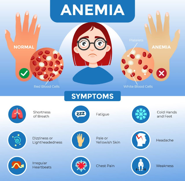 EMS Pathophysiology – Anemia