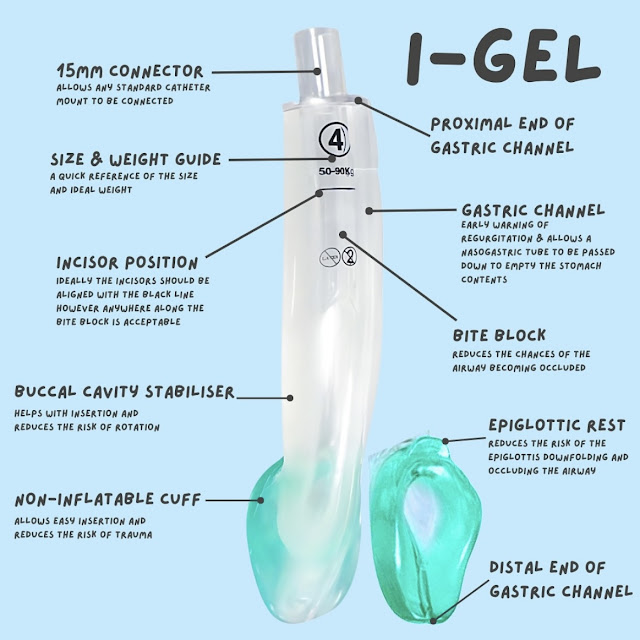 EMS Airway Management – iGel Supraglottic Airway Device