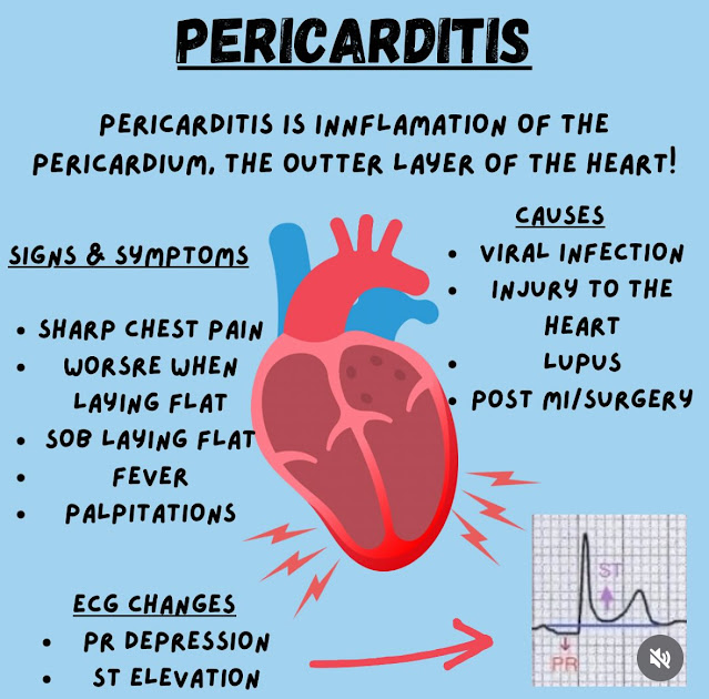 EMS Cardiac Emergencies – Pericarditis